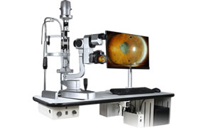 SLM-KD1數(shù)字化裂隙燈